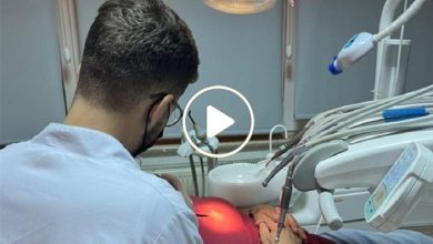 صورة طبيب سوري يتوصل إلى ابتكار مذهل في مجال تقويم الأسنان عجز عنه الخبراء لسنوات طويلة (فيديو)
